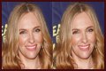 Toni Collette Teeth Before And After | What Is Wrong With Her Face